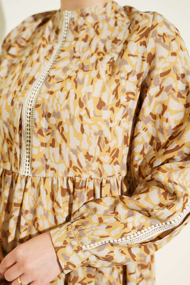 Lace-Trimmed Cuff Button Dress Mustard - Image 4
