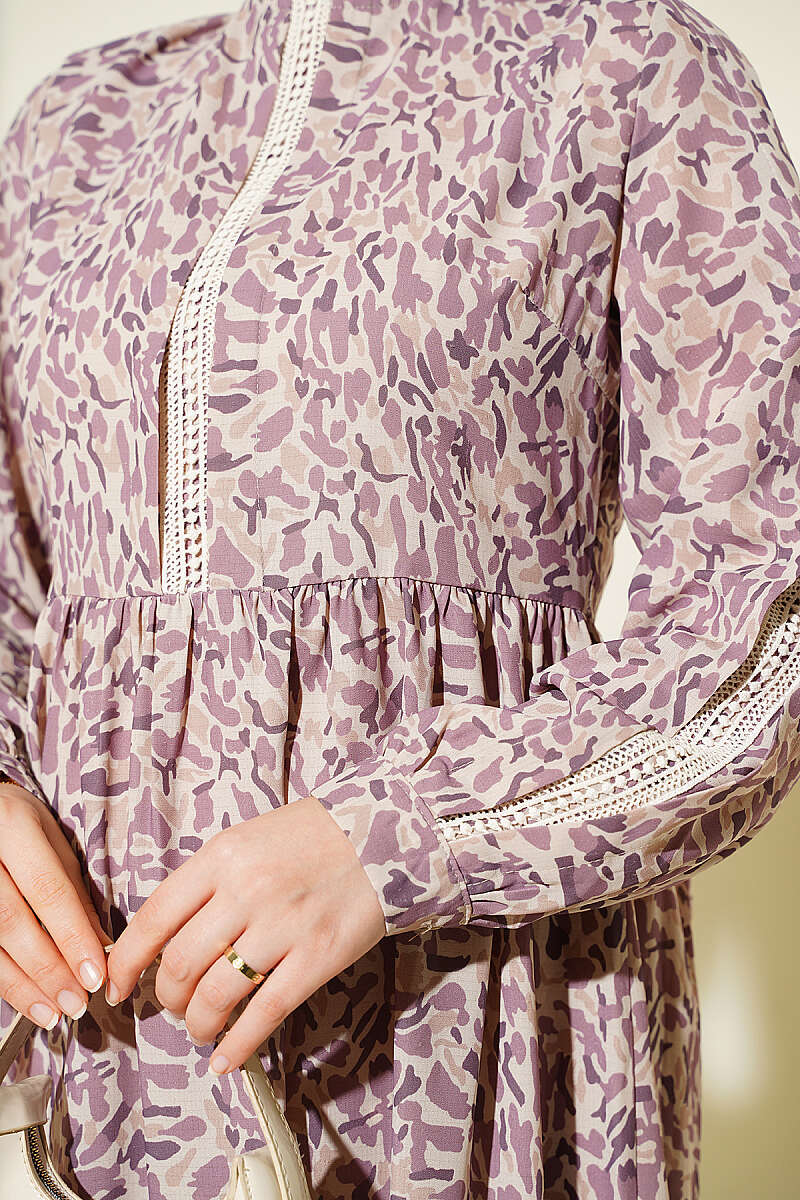 Lace-Trimmed Cuff Button Dress Lilac - Image 4